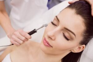 6 Benefits of Microneedling for Healthier Skin